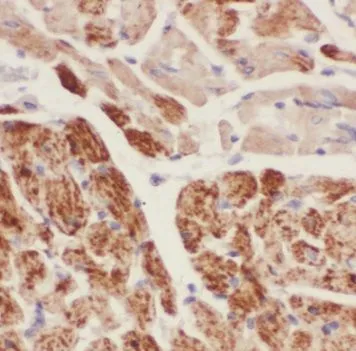 TAGLN antibody - image 1