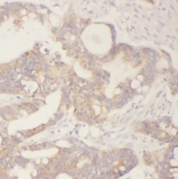 TAGLN antibody - image 1