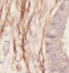 TAGLN-specific antibody - image 1