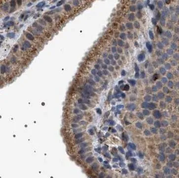 TRUB2 antibody - image 1