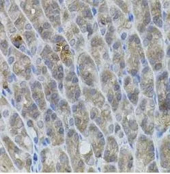 UBE2A antibody - image 1