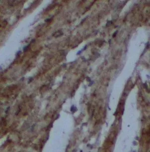 UBXN4 antibody - image 1