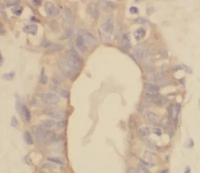 VPS25 antibody - image 1