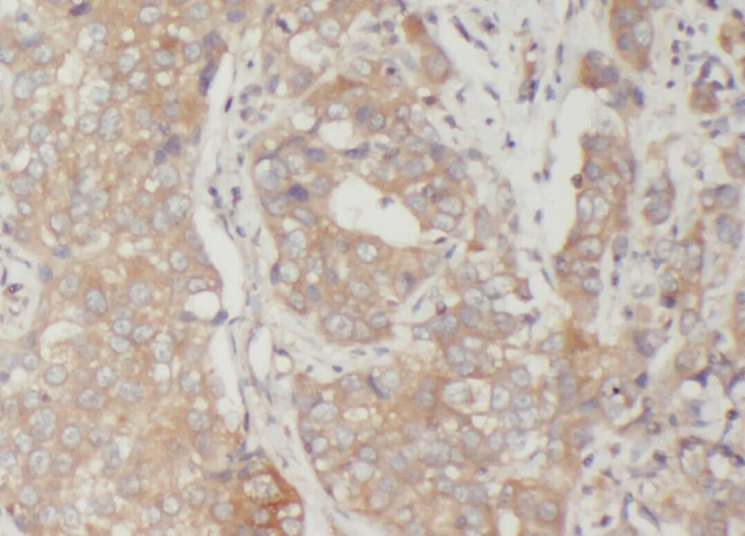 VTCN1 antibody - image 1