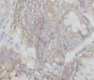 MAP3K20 antibody - image 1