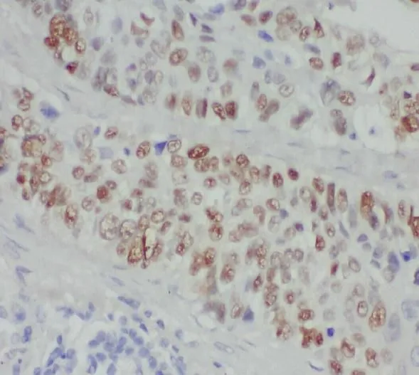 ZMYND8 antibody - image 1