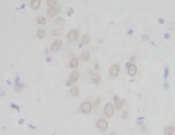 PCDH10 antibody - image 1