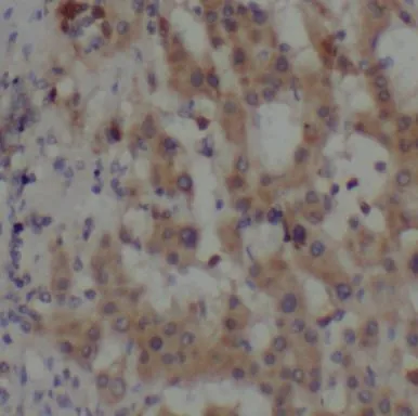 Beta Tubulin antibody - image 1