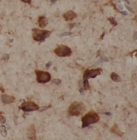 SNCA antibody - image 1