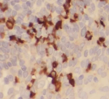 heavy chain Of IgG4 antibody - image 1