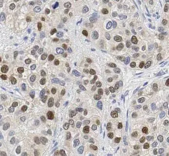 PARP1 antibody - image 1