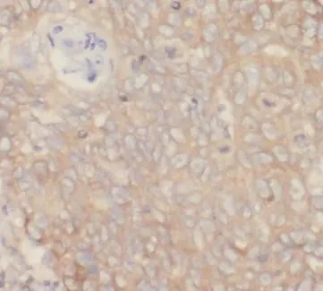 VCAM1 antibody - image 1