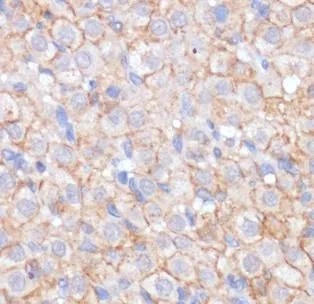 KIT antibody - image 1