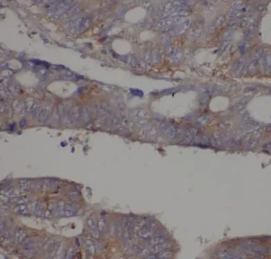 RP2 antibody - image 1