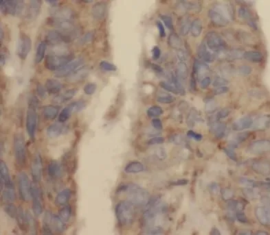 PINK1 antibody - image 1