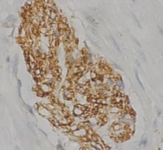 SNCB antibody - image 1
