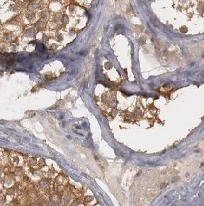 DDR1 antibody - image 1