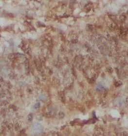 NCOR1 antibody - image 1