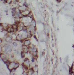 EGFR antibody - image 1