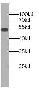 DAPK3 antibody - image 1