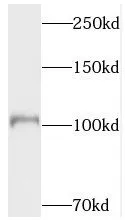 TOP3A antibody - image 1