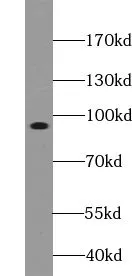 ZC3H11A antibody - image 1