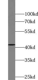 VSX2 antibody - image 1