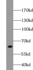 VPS45 antibody - image 1
