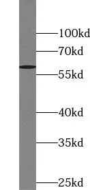 RO60 antibody - image 1