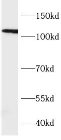 VPS39 antibody - image 1