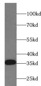 CD74 antibody - image 1