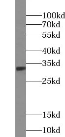 ULBP2 antibody - image 1