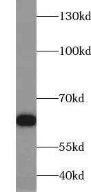 USP22 antibody - image 1