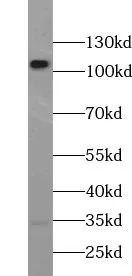 USP15 antibody - image 1