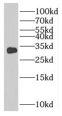 TNNT1 antibody - image 1