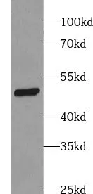 VPS4A antibody - image 1