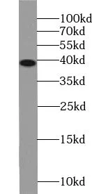 VPS26B antibody - image 1