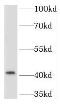 TMOD1 antibody - image 1