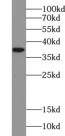 TRUB2 antibody - image 2