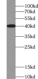 VASH2 antibody - image 1