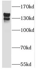 TRAPPC9 antibody - image 1