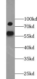 YY1AP1 antibody - image 1