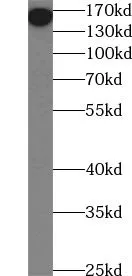 CD206 antibody - image 1