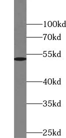 TSEN2 antibody - image 1