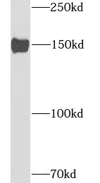 ATP7B antibody - image 1