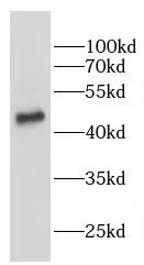 VRK2 antibody - image 1