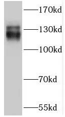 TRAPPC9 antibody - image 1