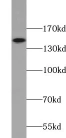 VPS8 antibody - image 1
