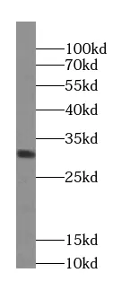 ZNRF2-Specific antibody - image 1