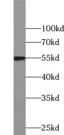 WARS2 antibody - image 1